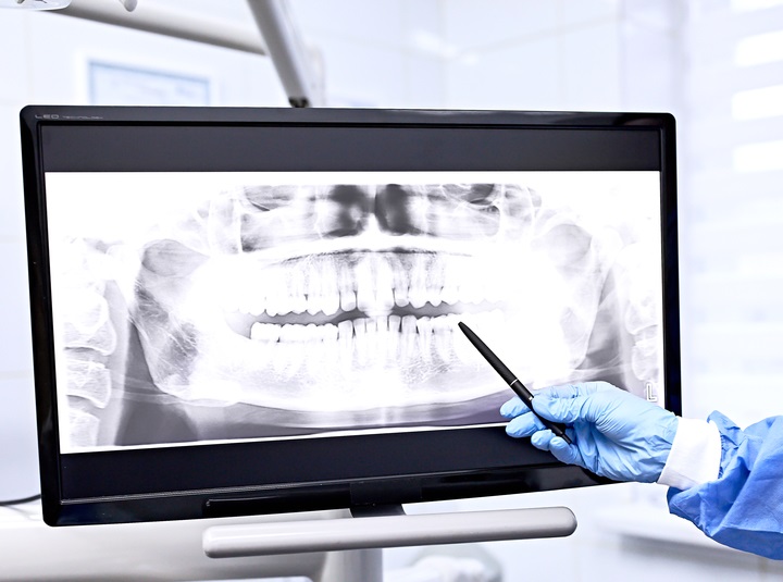 Dental Digital x-rays
