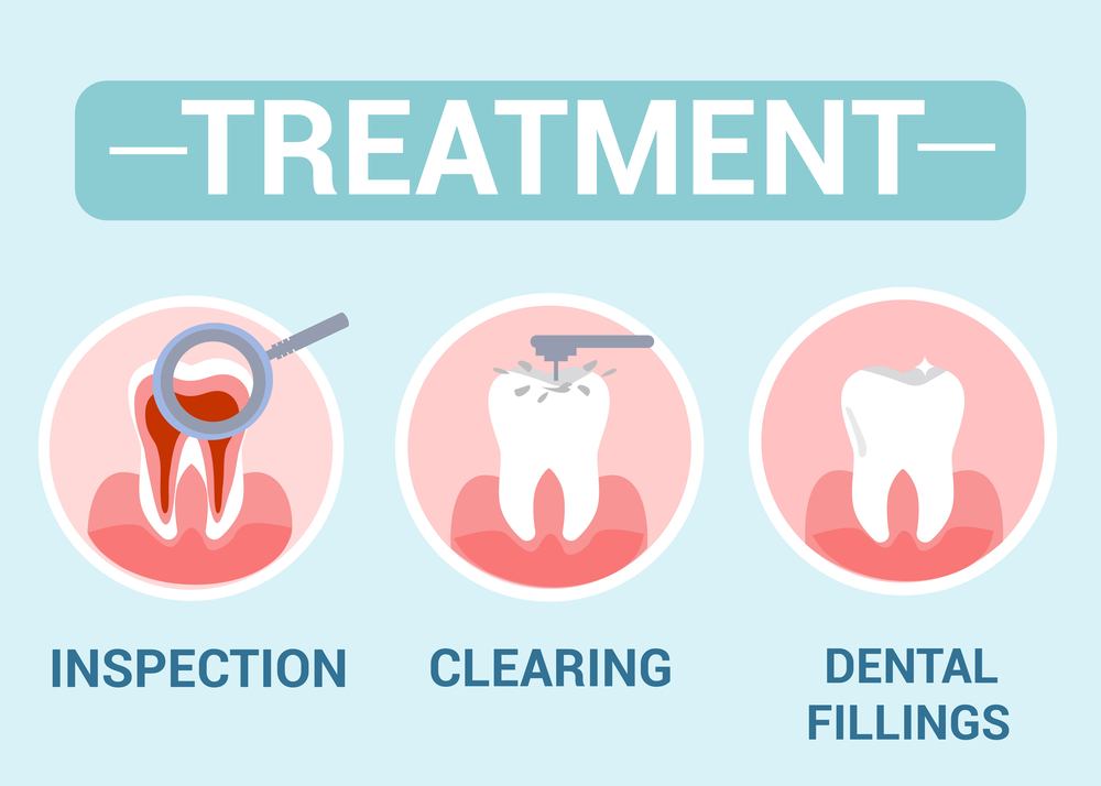 Dental filling in Denver infographic