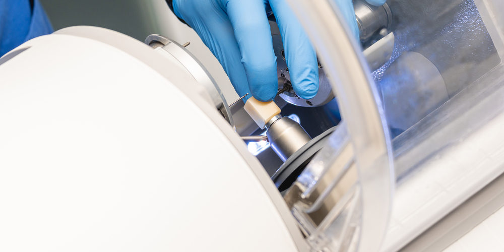 Advantages of Same Day Dental Crowns