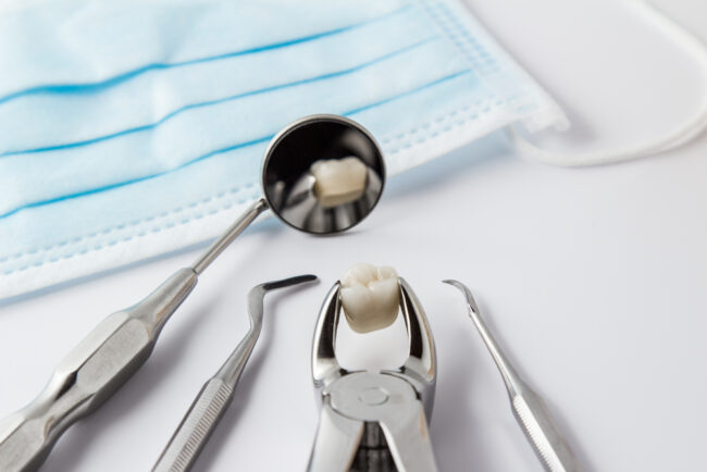 Tooth extraction procedure