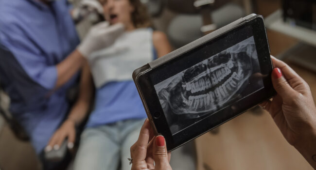 Digital Dental X-Ray in Denver