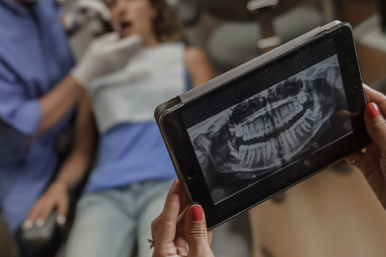 Digital Dental X-Ray in Denver